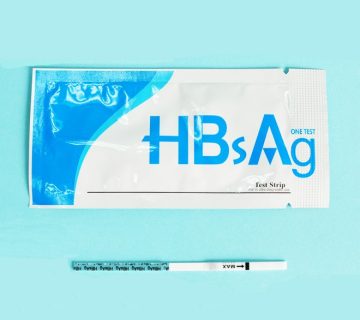 HBS Ag test