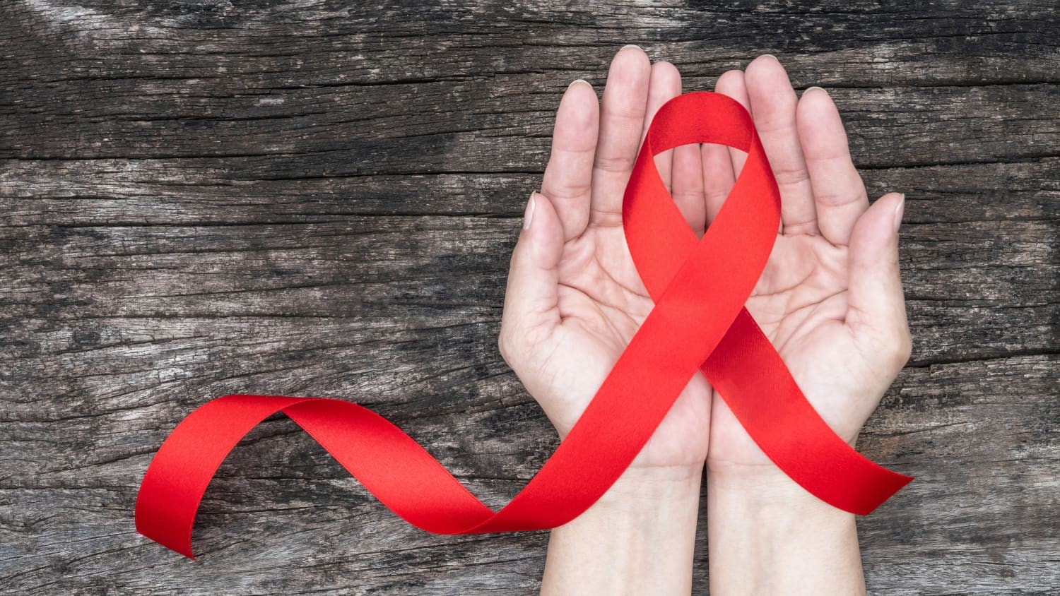 سندرم نقص ایمنی اکتسابی (AIDS)